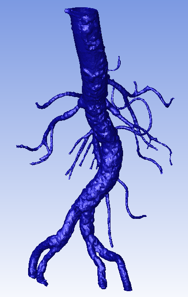 Aorta geometry, imported in STL format.