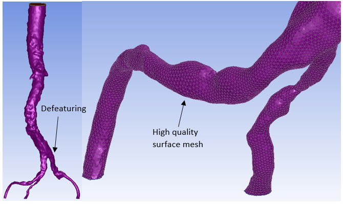 Tetrahedral surface mesh with defeaturing